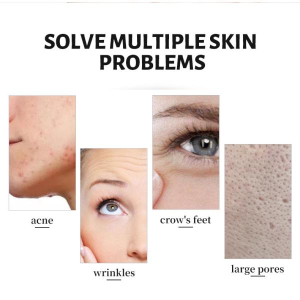 OABES Red Light Therapy 5 in 1 Red Light Infrared Light Blue Light for The Relief of Body Pain, Knees, Ankles, Hands