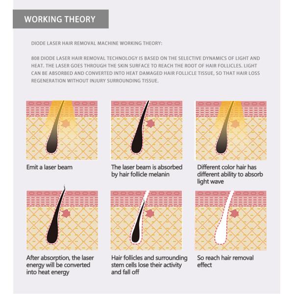Тип профессиональной машины удаления волос лазера диода TUV 1064nm вертикальный