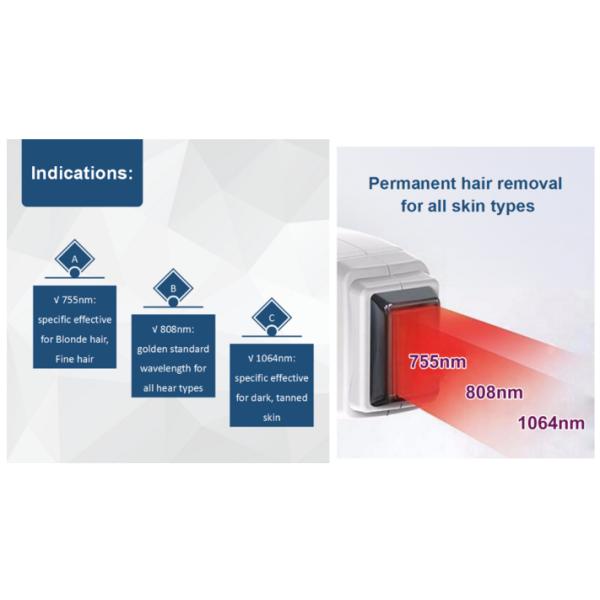 Professional 755 808 1064 808nm diode laser hair removal machine with CE approved