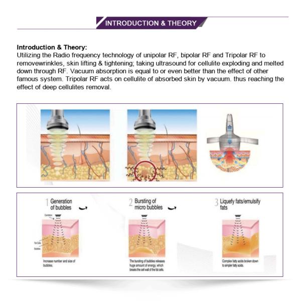40K Cavitation Vacuum Slimming Machine 1000W Professional In Body Shaper