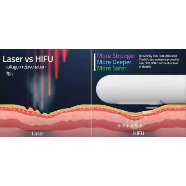 Ultrasonic 2 In 1 HIFU Machine For Women Tightening Rejuvenation