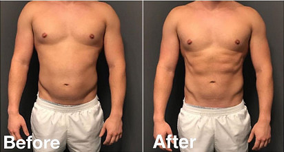 OEM 7 Tesla Pelvic Floor Muscle Strengthening Machine 2 Working Handles