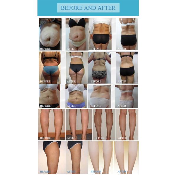 Lymphatic Drainage Body Massage Machine/body massage machine/massage machine