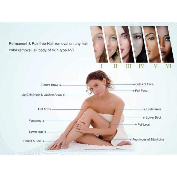 Permanent 1200W 808nm Laser Hair Removal Equipment