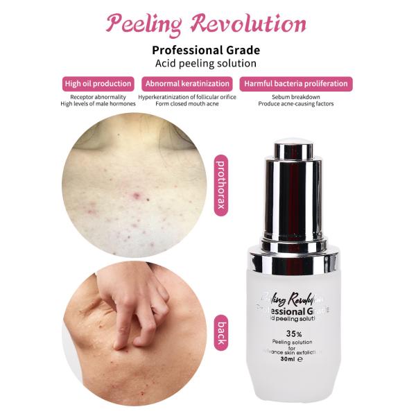Skin Exfoliating Serum Remove Dead Skin Exfoliation Oil Skin Peeling Solution