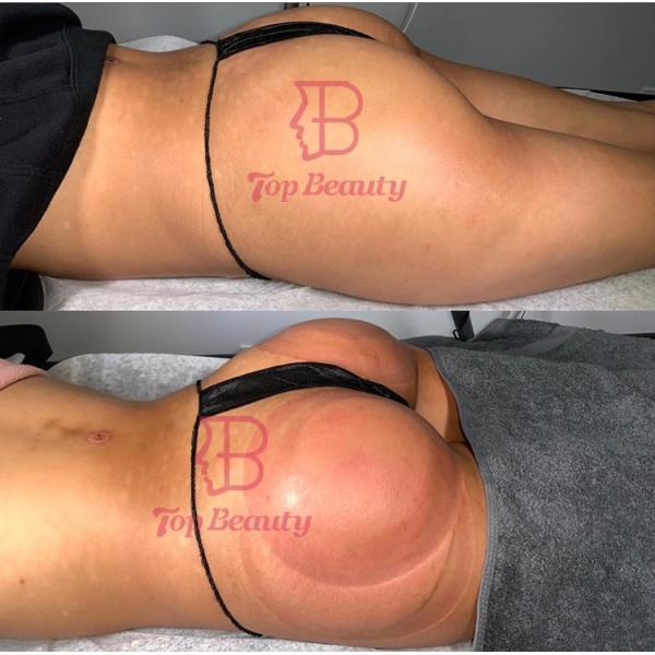 massager усиливающего агента груди вакуума чашки увеличения батокс машина батта электронного придавая форму чашки поднимаясь