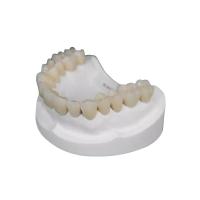 Couronne durable de bioxyde de zirconium aucune odeur aucune corrosion aucune irritation pour réduire en pulpe des nerfs