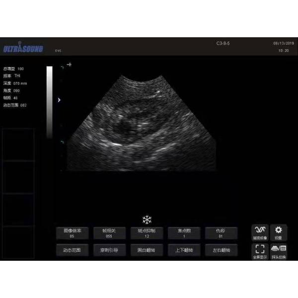 Hospital Outside Diagnostic Linear Ultrasound Machine Dog Ultrasound Machine Laptop Cow Pregnancy Sheep Scanner