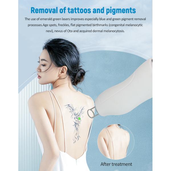 Supplier Dual Wavelength Laser Hair Removal Machine For Remove Tattoos And Pigment