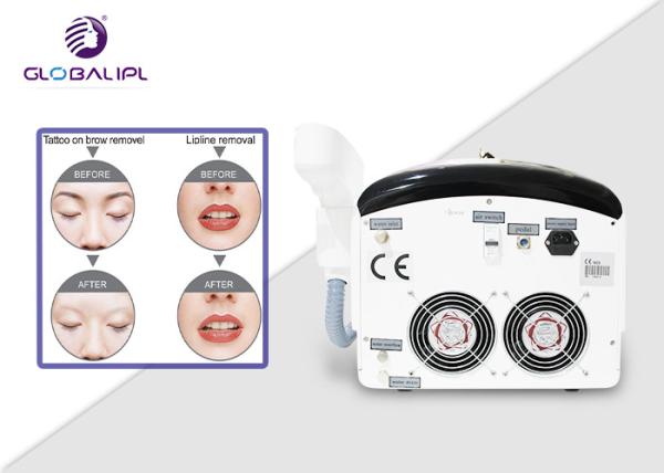 Picosecond Laser Pigmentation 1064nm 532nm Tattoo Removal Machine