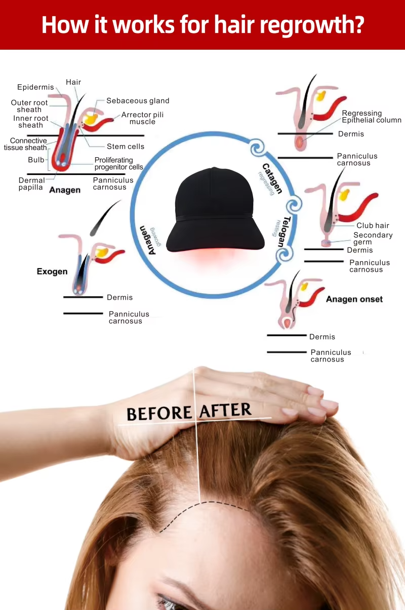 Home Use Red Light Therapy Hair Regrowth Scalp Treatment 660nm 850nm LED Hair Growth Caps