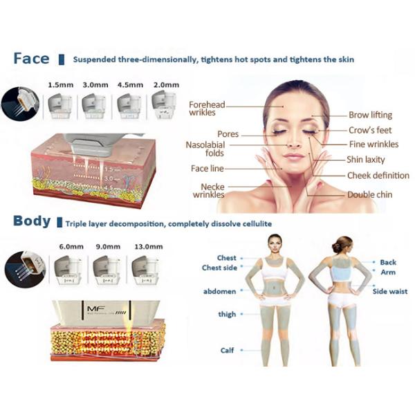 уменьшение красоты Hifu ультразвука тела машины Hifu подтяжки лица 3d 4d 7d