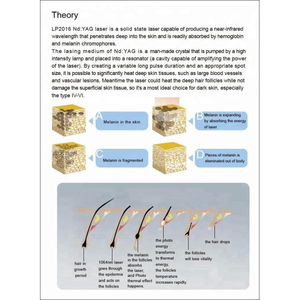 Manufacture ADSS ND YAG 1064nm Long Pulse Laser Hair Removal Laser Device