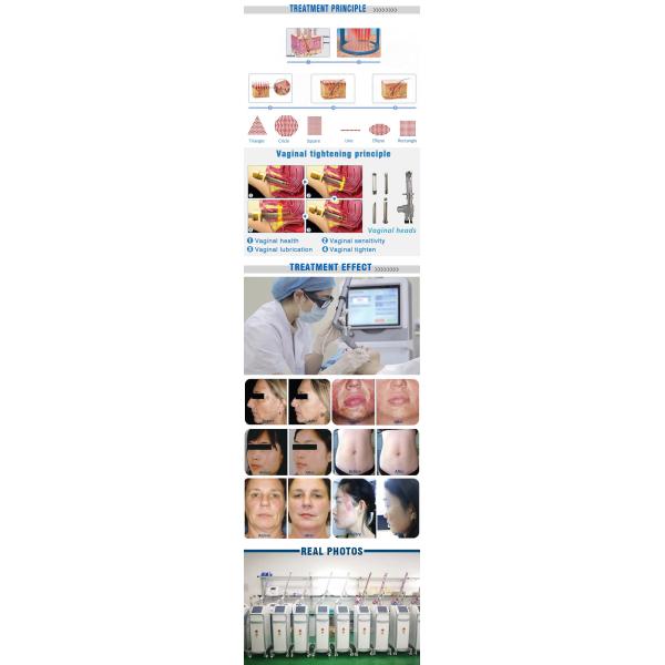 Подтяжка лица машины лазера СО2 водяного охлаждения OEM частичная