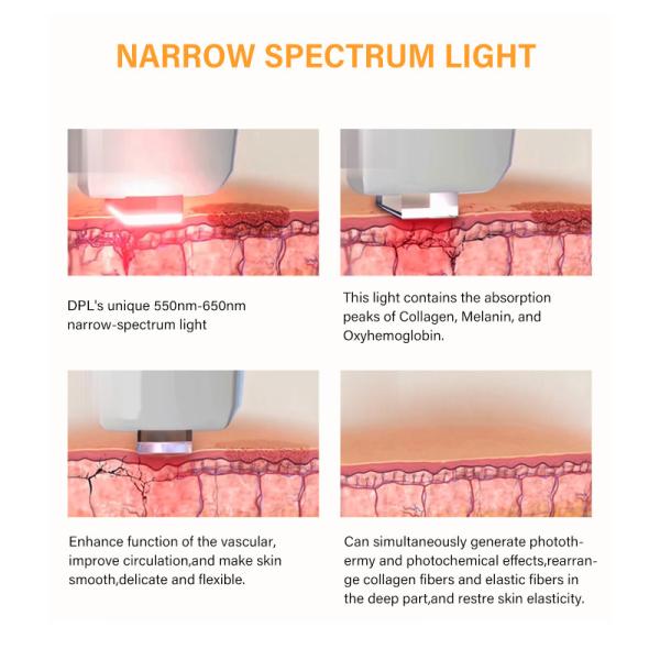 Spectrum Ellipse Photorajeunissement IPL SHR Laser Hair Removal Device With TUV