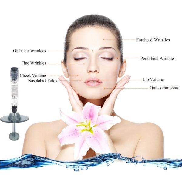 Neofiller Cross Linked HA Dermal Filler For Facial Volume Enhancement