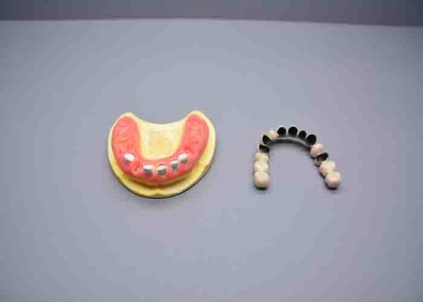 ISO 13485 Porcelain Dental Material Nickel Chrome Porcelain Metal with Be