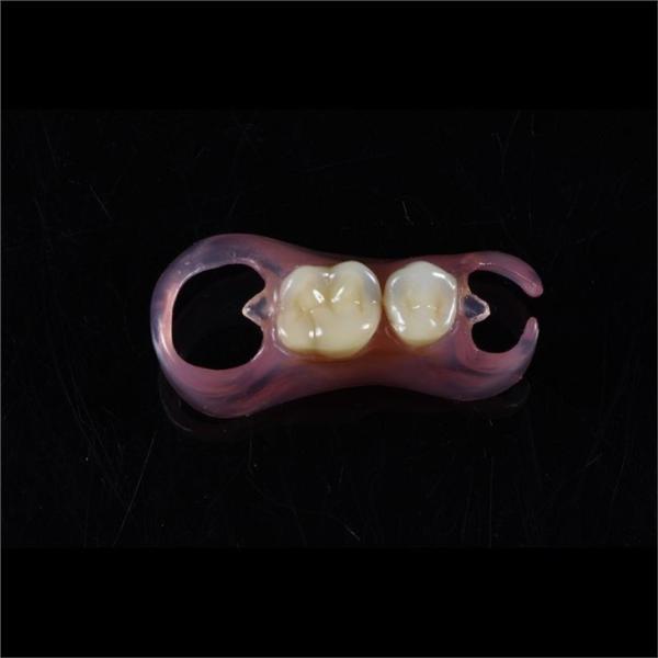 Comfortable Partial Valplast Flexible Dentures Nylon Material