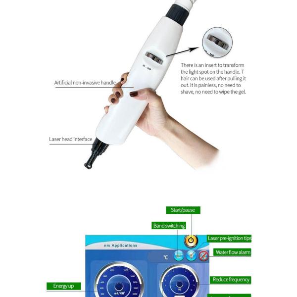 La peau Pico Carbon Facial Laser Machine tatouent le retrait 1064nm 532nm 1320nm