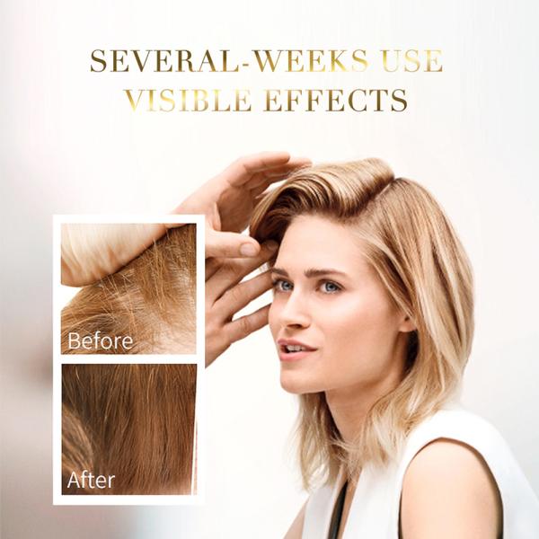 Polygonum Multiflorum Ginger Fast Hair Growth Serum Anti Hair Loss Liquid