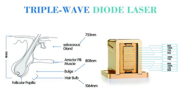 Professional ice soprano laser diode device hair removal triple wave medical laser on sale