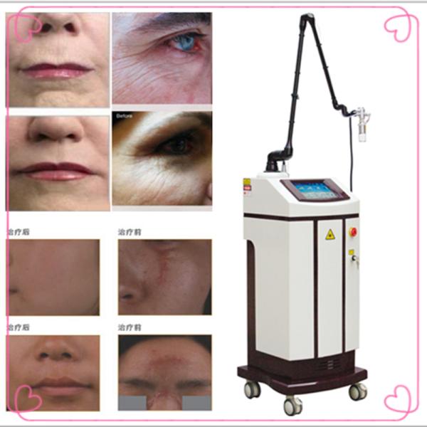 Co2 Fractional Laser Wrinkle Remover Machine Skin Tightening Acne Scar Removal