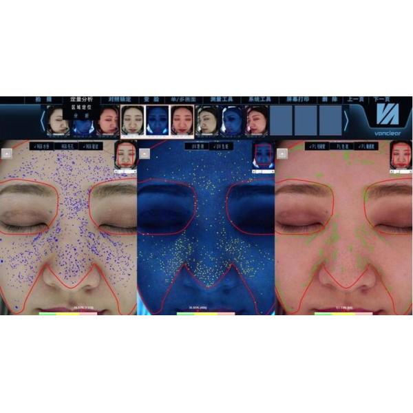 Visia Skin Analysis Machine , Magic Mirror Skin Analyzer Equipment With iPad