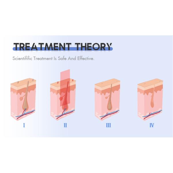 Машина удаления волос лазера веснушки пигмента подмолаживания кожи Dpl E-света OPT IPL