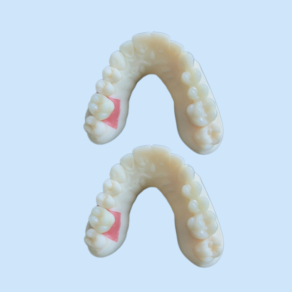 лаборатория Dentures дизайна CAD CAM цифровой модели 3D зубоврачебная