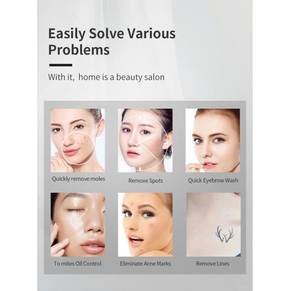 шелушение углерода машины удаления татуировки лазера пикосекунды 1064nm 532nm постоянное