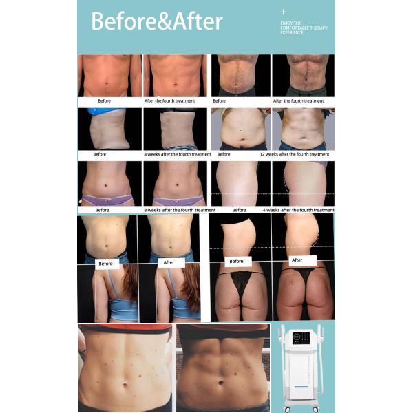 LF-448 HIEMT fat burning muscle stimulator beauty equipment