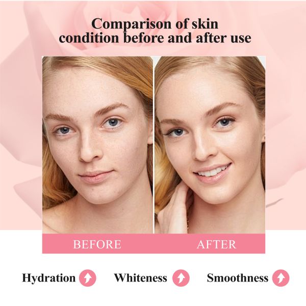 FM  ODM/OEM Rose Water Hydrating Mist with Rose Rugosa Flower Extract Hyaluronic Acid and Organic Collagen for Beauty Salon Use