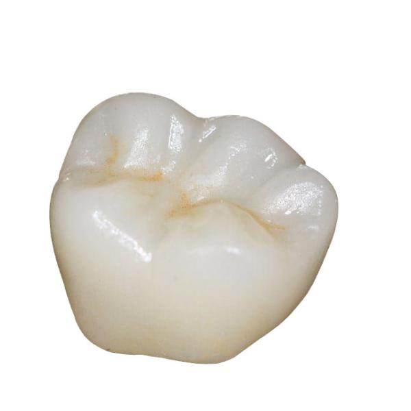 ISO Zirconia Dental Crown Computer Numerical Control Processing Good Biocompatibility
