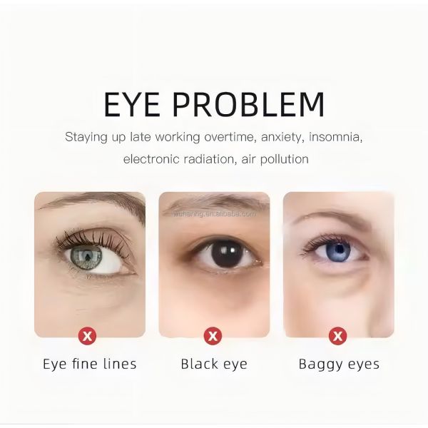 Hyaluronic Acid Microneedle Eye Patch Dissolving Microneedle Sheet For Eye Renewal