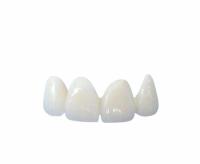 Fácil limpando todo o cerâmico coroa a máscara natural transparente customizável