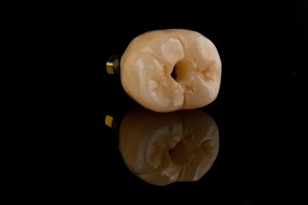 Oral Implantology Self Tapping Single Tooth Dental Implants With Internal Hex Connection