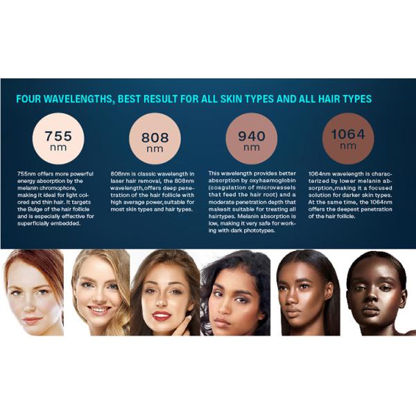 4 en 1 de diodo láser de depilación 4 longitud de onda 755 808 940 1064nm de diodo láser de depilación máquina