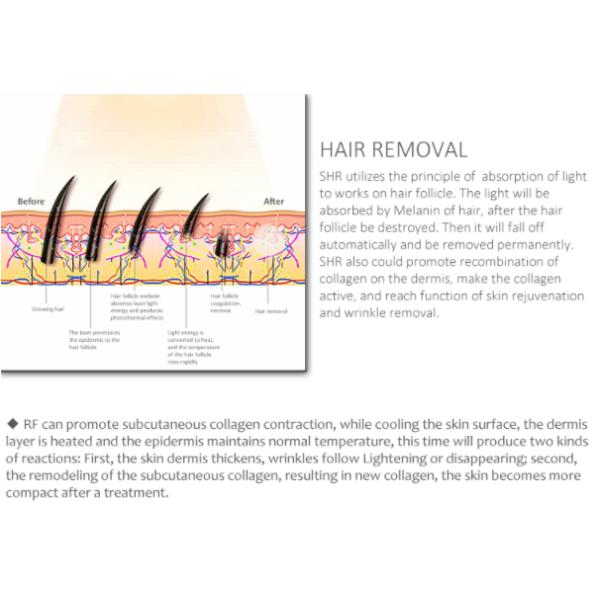 RF Elight Laser Hair Removal 2 Handpiece 640nm 560nm Skin Rejuvenation Machine