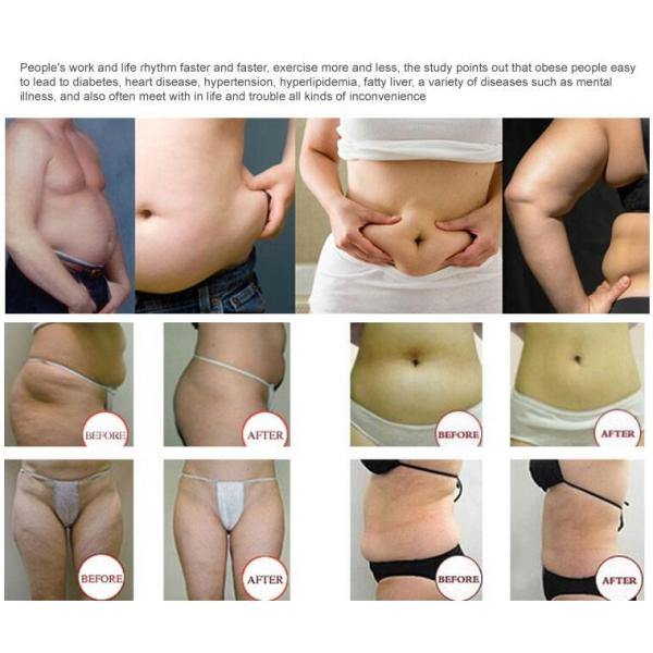Weight Loss Equipment Slimming Machine , Cryolipolysis Fat Loss Machines
