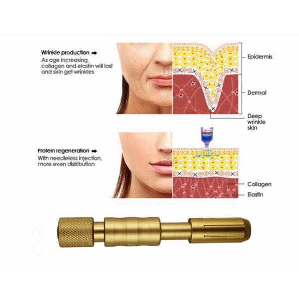Регулируемый Hyaluronic кисловочный заполнитель 0.3ml для ручки Hyaluron