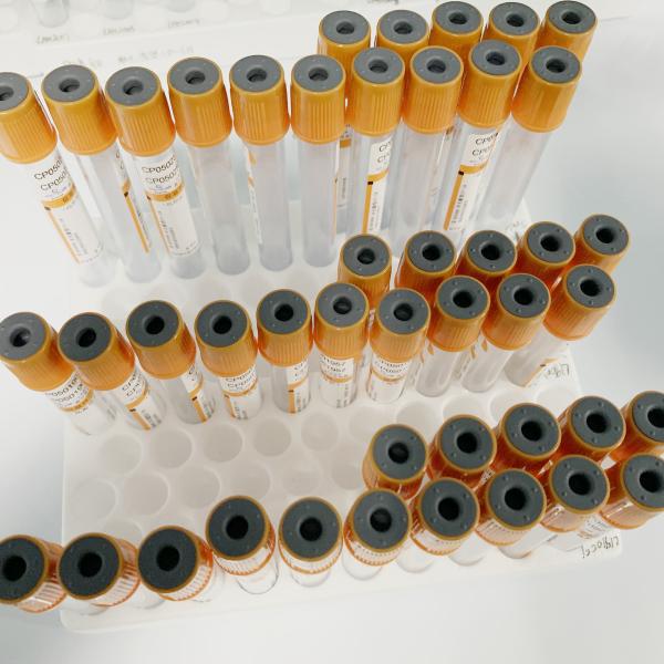 Эвакуированная высокая эффективность трубок 5-8 собрания пробы крови сыворотки минимальная