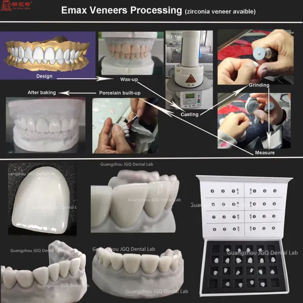 Tooth Like Shells Dental Porcelain Emax Veneers Dsd Design China Dental Lab