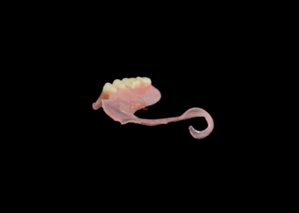 No Metal Showing Hypoallergenic Flexible Partial Denture with 3-Day Turnaround for Comfortable Dental Restoration