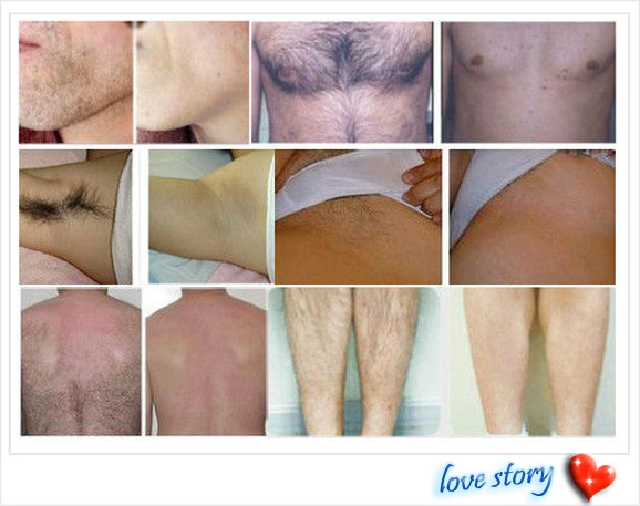 Professional 808nm Diode Laser Hair Remover For Chest / Back / Bikini / Neck