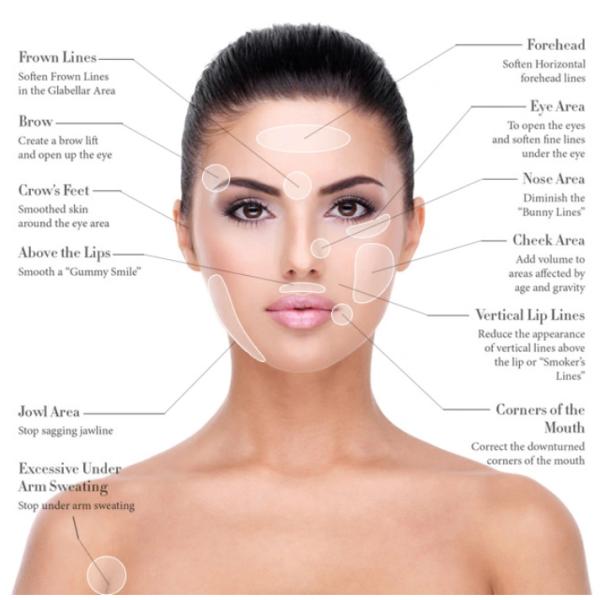 Тип токсина  Botulinum отрава добавляет 2ml - нормальное соляное 2.5ml