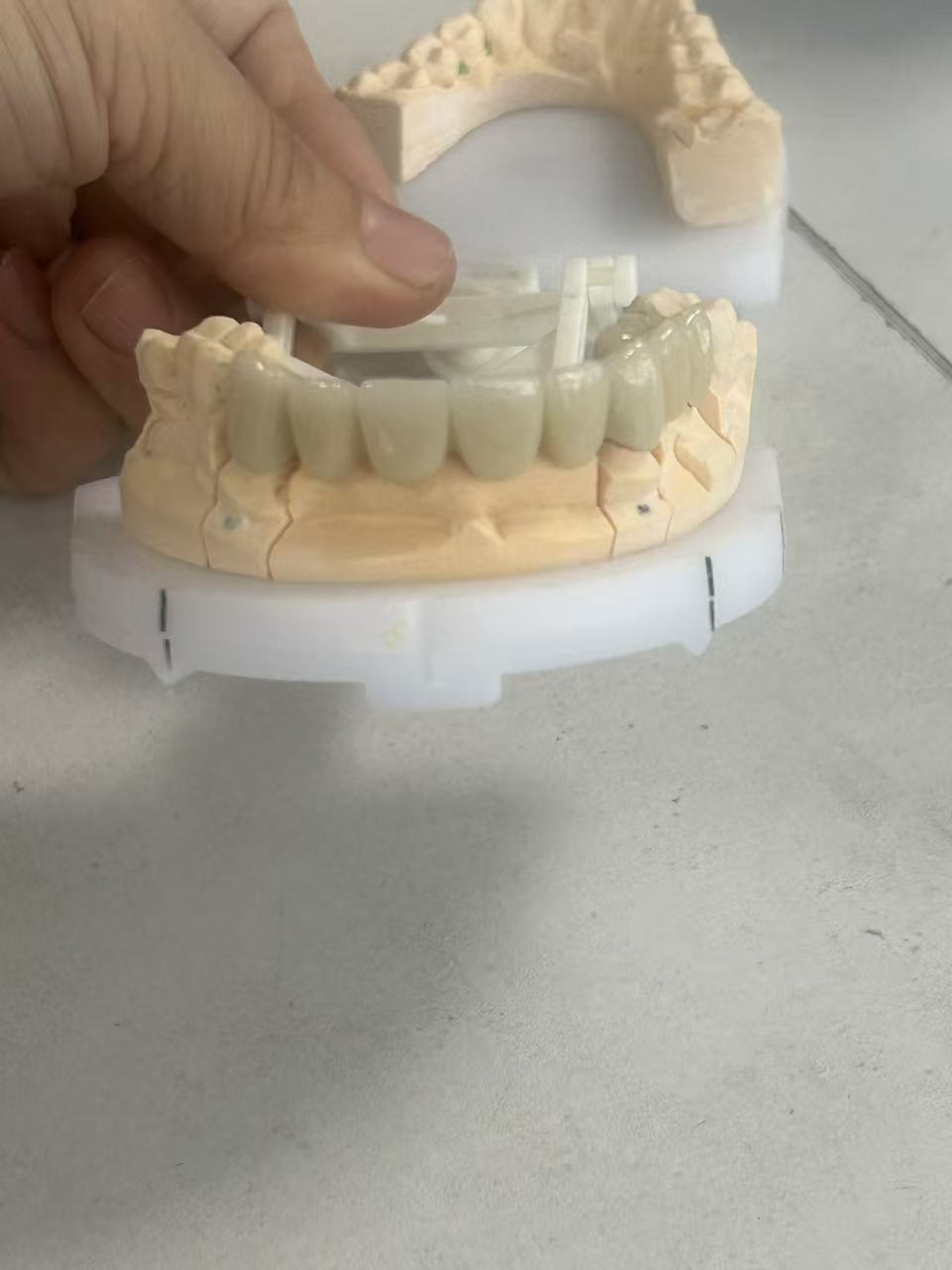 High Fracture Resistance Full Zirconia Dental Crown with Natural Translucency and CAD/CAM Digital Production