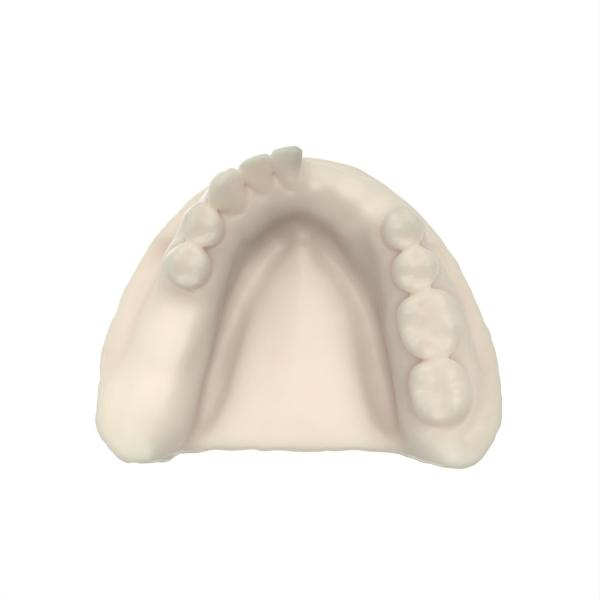 Night Grinding Solution 3d Dental Resin Temperature Sensitive Opposite Jaw Model Resin