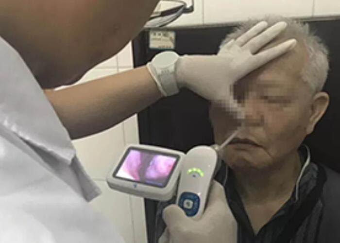 Мобильный Handheld портативный Laryngoscope и Rhinoscope Otoscope цифров видео- с мини хранением перезарядки 32G USB внутренним
