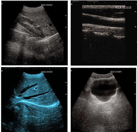 B/W Trolley Ultrasound Scanner For Clinic With Three Probe Connectors