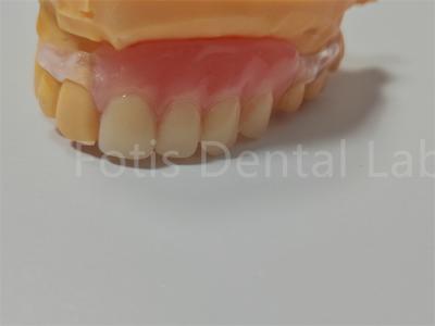 FDA/ISO Certification TCS Valplast Flexible Dentures Easy To Clean Adjust